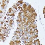 PNLIPRP1 Polyclonal Antibody