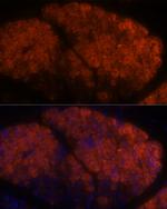PNLIPRP1 Antibody in Immunohistochemistry (Paraffin) (IHC (P))