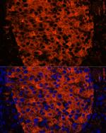 PNLIPRP1 Antibody in Immunohistochemistry (Paraffin) (IHC (P))