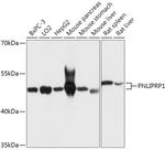PNLIPRP1 Antibody in Western Blot (WB)