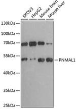 PNMAL1 Antibody in Western Blot (WB)