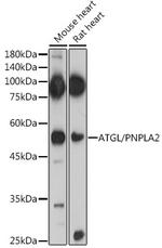 ATGL Antibody in Western Blot (WB)