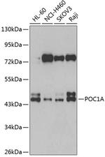 POC1A Polyclonal Antibody