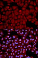 PPP1CB Polyclonal Antibody