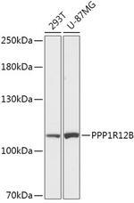 PPP1R12B Polyclonal Antibody