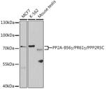 PPP2R5C Polyclonal Antibody