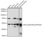 PPP2R5E Polyclonal Antibody
