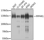 PPP4R1 Polyclonal Antibody