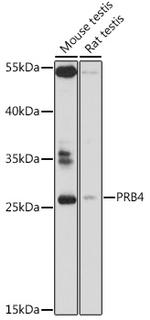 PRB4 Polyclonal Antibody