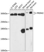 PRDM2 Polyclonal Antibody