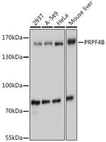PRPF4B Antibody in Western Blot (WB)