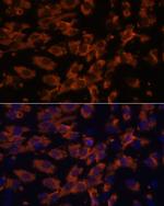 PRX Antibody in Immunocytochemistry (ICC/IF)