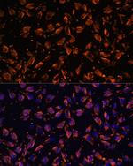 PRX Antibody in Immunocytochemistry (ICC/IF)
