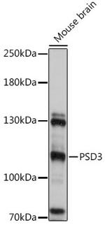 PSD3 Polyclonal Antibody