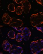 PSG1 Polyclonal Antibody