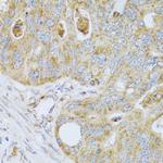 PSG1 Antibody in Immunohistochemistry (Paraffin) (IHC (P))
