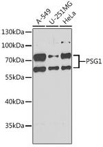 PSG1 Antibody in Western Blot (WB)