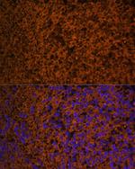 PTCH Polyclonal Antibody