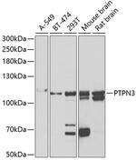 PTPN3 Polyclonal Antibody