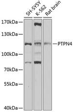 PTPN4 Polyclonal Antibody