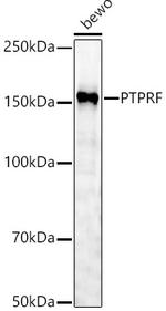 PTPRF Polyclonal Antibody