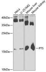 PTS Polyclonal Antibody