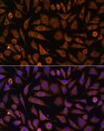 RAB1A Polyclonal Antibody