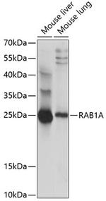 RAB1A Antibody in Western Blot (WB)