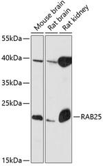 RAB25 Polyclonal Antibody