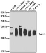 RAB31 Polyclonal Antibody