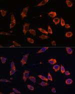 RAB5B Polyclonal Antibody