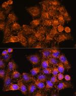 RAB7B Polyclonal Antibody