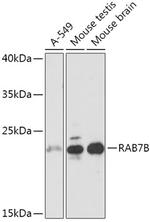 RAB7B Antibody in Western Blot (WB)