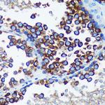 RABGAP1 Antibody in Immunohistochemistry (Paraffin) (IHC (P))