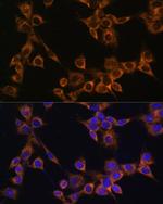 RAMP1 Polyclonal Antibody
