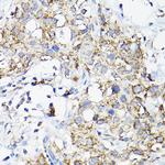 RAMP2 Polyclonal Antibody