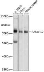 RANBP10 Polyclonal Antibody