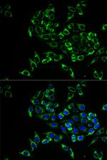 RANKL Antibody in Immunocytochemistry (ICC/IF)