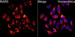 RARS Antibody in Immunocytochemistry (ICC/IF)
