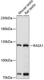 RASA1 Polyclonal Antibody