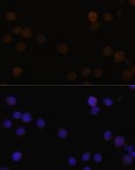 Rb Antibody in Immunocytochemistry (ICC/IF)