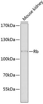 Rb Antibody in Western Blot (WB)
