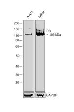 Rb Antibody in Western Blot (WB)