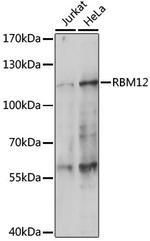 RBM12 Polyclonal Antibody