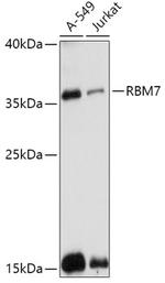 RBM7 Polyclonal Antibody