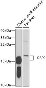 RBP2 Antibody in Western Blot (WB)