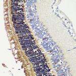Recoverin Polyclonal Antibody