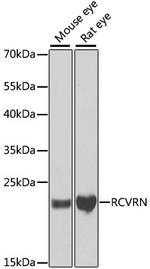Recoverin Antibody in Western Blot (WB)