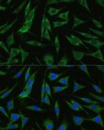 RHBDD1 Polyclonal Antibody