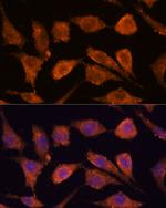 RHBDF1 Polyclonal Antibody